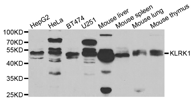 Western blot analysis of extracts of various cell lines, using KLRK1 antibody.