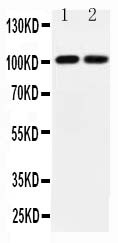 WB of GRIA3 / GLUR3 antibody. All lanes: Anti-GRIA3 at 0.5ug/ml. Lane 1: Rat Brain Tissue Lysate at 40ug. Lane 2: Mouse Brain Tissue Lysate at 40ug. Predicted bind size: 101KD. Observed bind size: 101KD.