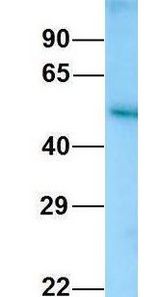 KMO antibody Western Blot of Human Fetal Kidney. Antibody Dilution: 1.0 ug/ml. Antibody dilution: 1 ug/ml.