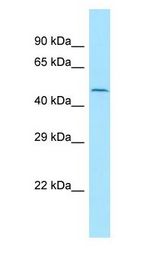 KMO antibody Western Blot of OVCAR-3.