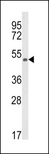Western blot of KMO Antibody in CEM cell line lysates (35 ug/lane). KMO (arrow) was detected using the purified antibody.