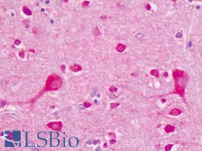 Anti-GRIA3 / GLUR3 antibody IHC staining of human brain, cortex neurons. Immunohistochemistry of formalin-fixed, paraffin-embedded tissue after heat-induced antigen retrieval.