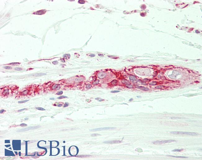 Anti-KMT2B / MLL4 antibody IHC staining of human small intestine. Immunohistochemistry of formalin-fixed, paraffin-embedded tissue after heat-induced antigen retrieval. Antibody LS-B11281 concentration 5 ug/ml.
