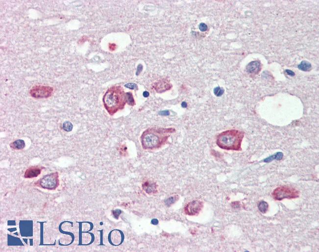 Anti-MLL4 antibody IHC of human brain, cortex. Immunohistochemistry of formalin-fixed, paraffin-embedded tissue after heat-induced antigen retrieval. Antibody LS-B3595 concentration 5 ug/ml.