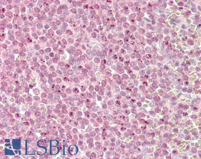 Anti-MLL2 antibody IHC of human spleen. Immunohistochemistry of formalin-fixed, paraffin-embedded tissue after heat-induced antigen retrieval. Antibody LS-B8291 dilution 3.75 ug/ml.
