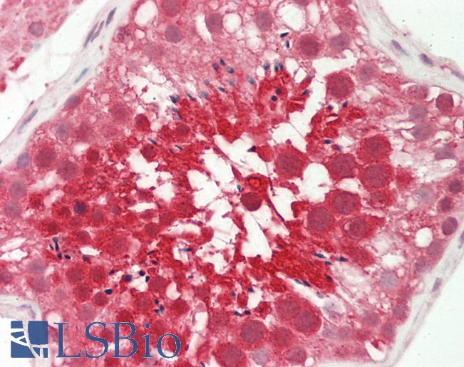 Human Testis: Formalin-Fixed, Paraffin-Embedded (FFPE)