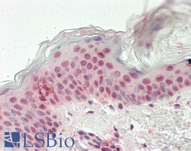 Human Skin: Formalin-Fixed, Paraffin-Embedded (FFPE)