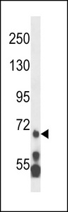 MLL5 Antibody western blot of HL-60 cell line lysates (35 ug/lane). The MLL5 antibody detected the MLL5 protein (arrow).