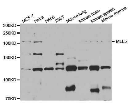 Western blot analysis of extracts of various cell lines, using MLL5 antibody.