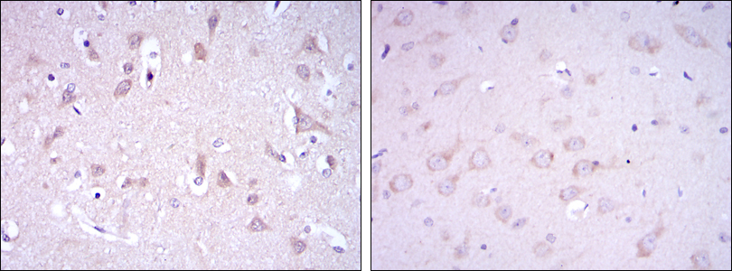 IHC of paraffin-embedded human brain tissues (left) and rat brain tissues (right) using GRIA3 mouse monoclonal antibody with DAB staining.