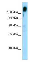 KNDC1 antibody Western Blot of PANC1.