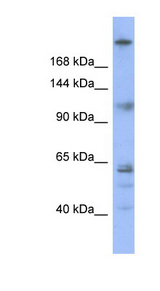 KNTC1 antibody LS-C107491 Western blot of OVCAR-3 cell lysate.
