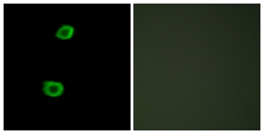 Immunofluorescence of HepG2 cells, using LMTK2 Antibody. The picture on the right is treated with the synthesized peptide.