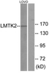 Western blot of extracts from LOVO cells, using LMTK2 Antibody. The lane on the right is treated with the synthesized peptide.