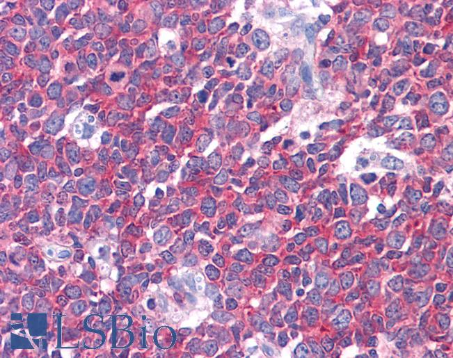 Anti-LMTK2 antibody IHC of human tonsil. Immunohistochemistry of formalin-fixed, paraffin-embedded tissue after heat-induced antigen retrieval. Antibody LS-B4518 concentration 5 ug/ml.