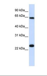 721_B cell lysate. Antibody concentration: 1.0 ug/ml. Gel concentration: 12%.