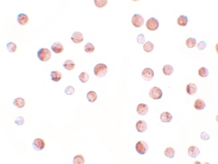 Immunocytochemistry of KPNA1 in HeLa cells with KPNA1 antibody at 2.5 ug/ml.