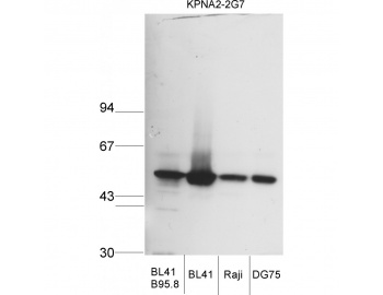 Western blot of KPNA2 / Importin Alpha 1 antibody LS-C82304.
