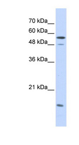 KPNA2 antibody LS-C102563 Western blot of Transfected 293T cell lysate.