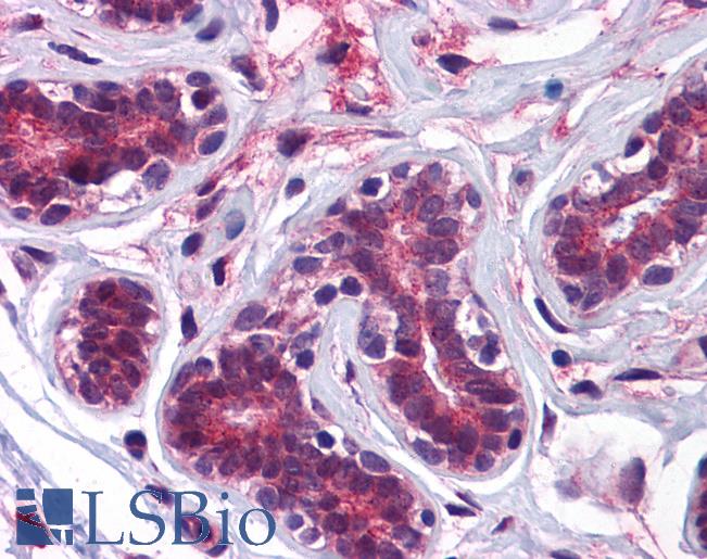 Anti-KPNA2 antibody IHC of human breast. Immunohistochemistry of formalin-fixed, paraffin-embedded tissue after heat-induced antigen retrieval. Antibody LS-B5340 concentration 5 ug/ml.