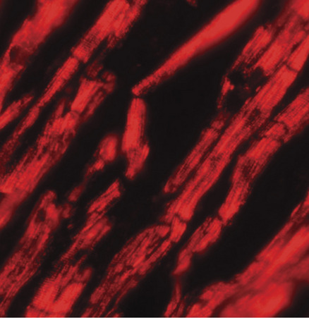 Immunofluorescence of KPNA2 in human heart tissue with KPNA2 antibody at 20 ug/ml.