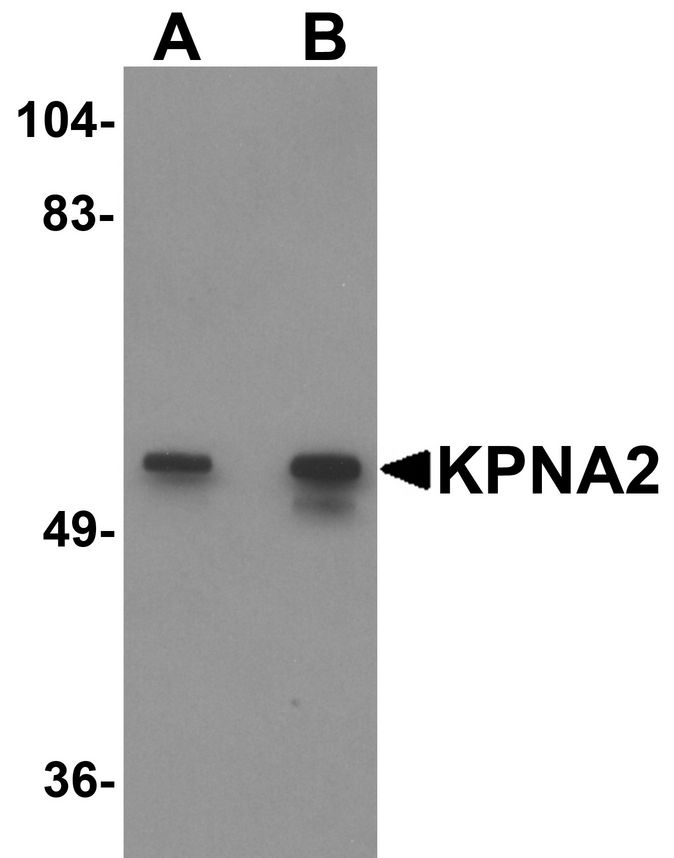 Western blot analysis of KPNA2 in rat heart tissue lysate with KPNA2 antibody at (A) 1 and (B) 2 ug/ml.