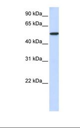 MCF7 cell lysate. Antibody concentration: 1.0 ug/ml. Gel concentration: 12%.