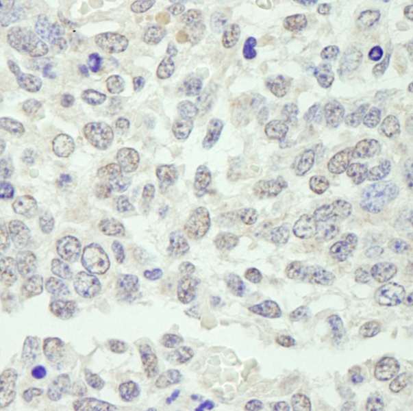 Detection of Mouse KPNA3 by Immunohistochemistry. Sample: FFPE section of mouse teratoma. Antibody: Affinity purified rabbit anti-KPNA3 used at a dilution of 1:250.