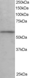Antibody staining (0.1 ug/ml) of Human Testis lysate (RIPA buffer, 35 ug total protein per lane). Primary incubated for 1 hour. Detected by Western blot of chemiluminescence.