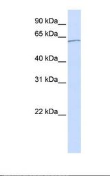 Jurkat cell lysate. Antibody concentration: 1.0 ug/ml. Gel concentration: 12%.