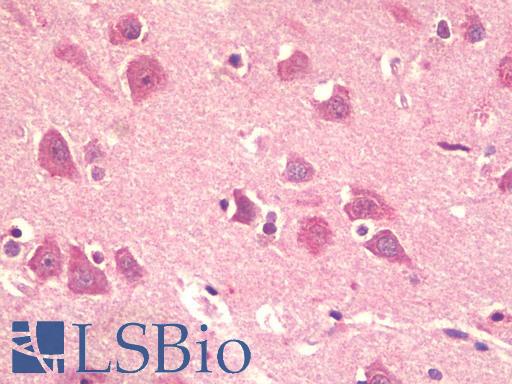 Anti-KPNA5 antibody IHC staining of human brain, cortex. Immunohistochemistry of formalin-fixed, paraffin-embedded tissue after heat-induced antigen retrieval. Antibody LS-B9592 concentration 5 ug/ml.