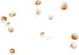 Immunocytochemistry of KPNA5 in EL4 cells with KPNA5 antibody at 5 µg/mL.