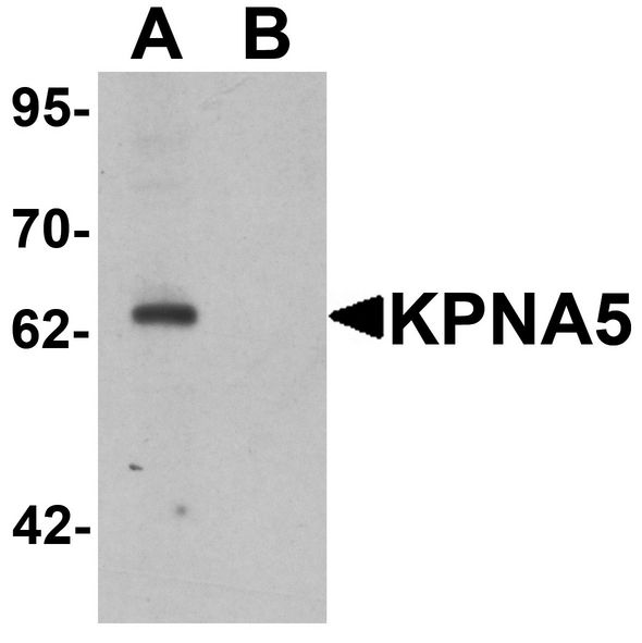 Western blot analysis of KPNA6 in EL4 cell lysate with KPNA5 antibody at 1 ug/ml in (A) the absence and (B) the presence of blocking peptide.
