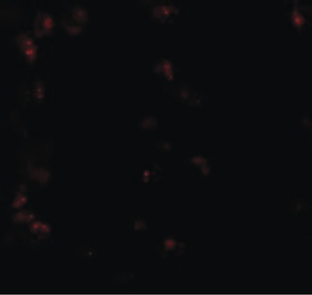 Immunofluorescence of KPNA6 in 293 cells with KPNA6 antibody at 20 ug/ml.
