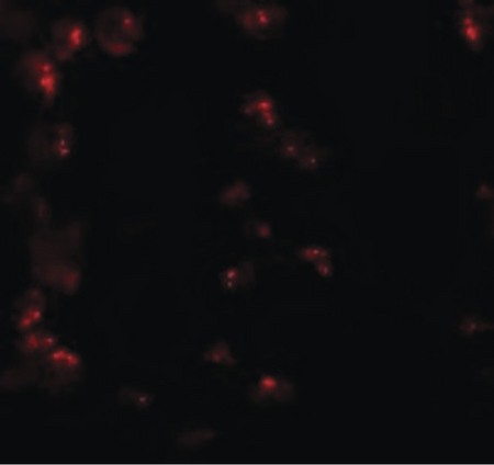 Immunofluorescence of KPNA6 in 293 cells with KPNA6 antibody at 20 ug/ml.