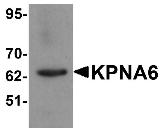 Western blot analysis of KPNA6 in 293 cell lysate with KPNA6 antibody at 1 ug/ml.