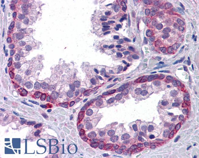 Anti-KPNA6 antibody IHC of human prostate. Immunohistochemistry of formalin-fixed, paraffin-embedded tissue after heat-induced antigen retrieval. Antibody LS-B4460 concentration 3.75 ug/ml.