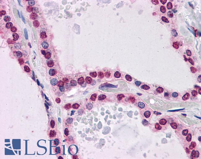 Anti-KPNA7 antibody IHC of human thyroid. Immunohistochemistry of formalin-fixed, paraffin-embedded tissue after heat-induced antigen retrieval. Antibody LS-B4729 concentration 5 ug/ml.