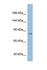 KPNB1 antibody LS-C145499 Western blot of ACHN Cell lysate. Antibody concentration 1 ug/ml.