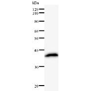 Western blot analysis of immunized recombinant protein, using anti-KPNB1 monoclonal antibody.