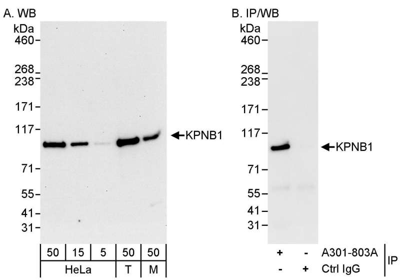 Detection of Human and Mouse KPNB1 by Western Blot (h&m) and Immunoprecipitation (h). Samples: Whole cell lysate from HeLa (5, 15 and 50 ug for WB; 1 mg for IP, 20% of IP loaded), 293T (T; 50 ug), and mouse NIH3T3 (M; 50 ug) cells. Antibodies: Affinity purified rabbit anti-KPNB1 antibody used for WB at 0.04 ug/ml (A) and 1 ug/ml (B) and used for IP at 3 ug/mg lysate. Detection: Chemiluminescence with exposure times of 30 seconds (A) and 10 seconds (B).