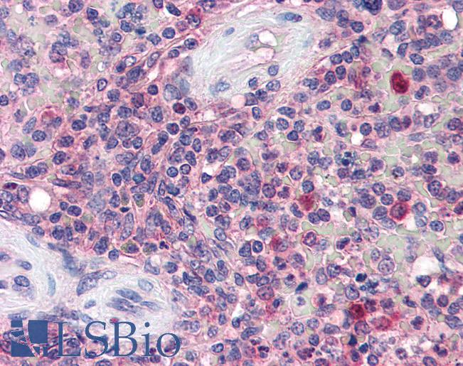 Anti-KPNB1 antibody IHC of human spleen. Immunohistochemistry of formalin-fixed, paraffin-embedded tissue after heat-induced antigen retrieval. Antibody LS-B2533 concentration 5 ug/ml.