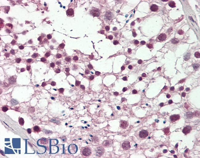 Human Testis: Formalin-Fixed, Paraffin-Embedded (FFPE)