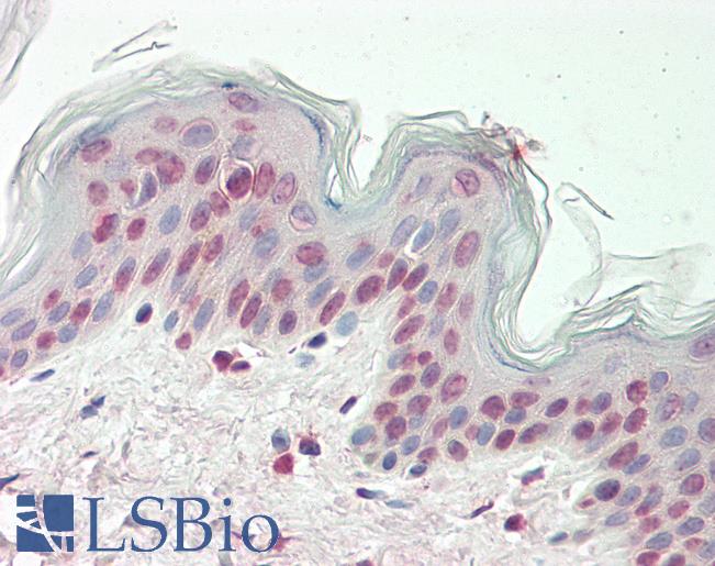 Human Skin: Formalin-Fixed, Paraffin-Embedded (FFPE)