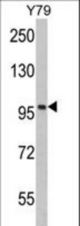 Western blot of KPNB1 Antibody in Y79 cell line lysates (35 ug/lane). KPNB1 (arrow) was detected using the purified antibody.