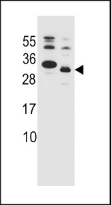 KRAS2 Antibody western blot of WiDr cell line and mouse lung tissue lysates (35 ug/lane). The KRAS2 antibody detected the KRAS2 protein (arrow).