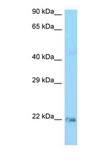 KRAS antibody LS-C146279 Western blot of Rat Lung lysate. Antibody concentration 1 ug/ml.