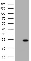 HEK293T cells were transfected with the pCMV6-ENTRY control (Left lane) or pCMV6-ENTRY KRAS (Right lane) cDNA for 48 hrs and lysed. Equivalent amounts of cell lysates (5 ug per lane) were separated by SDS-PAGE and immunoblotted with anti-KRAS.