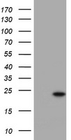 HEK293T cells were transfected with the pCMV6-ENTRY control (Left lane) or pCMV6-ENTRY KRAS (Right lane) cDNA for 48 hrs and lysed. Equivalent amounts of cell lysates (5 ug per lane) were separated by SDS-PAGE and immunoblotted with anti-KRAS.