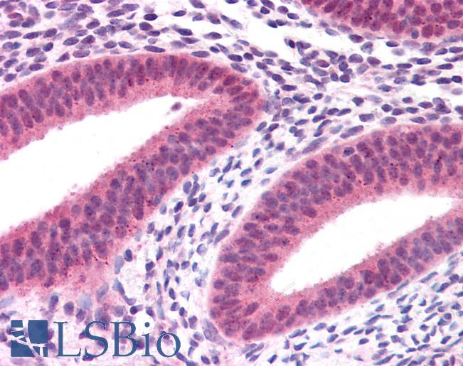 Anti-KRAS antibody IHC of human uterus. Immunohistochemistry of formalin-fixed, paraffin-embedded tissue after heat-induced antigen retrieval. Antibody LS-B4683 concentration 5 ug/ml.